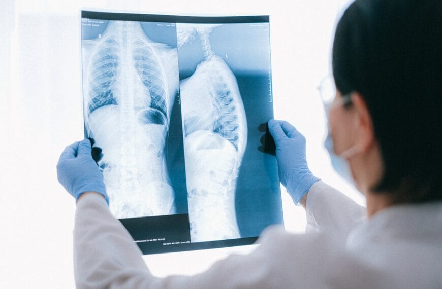 X (Röntgen) Işınları: Keşiften Günümüze Bilim ve Tıbbın Görünmez Gücü